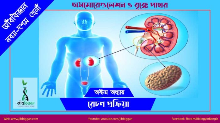 অসমোরেগুলেশন-ও-বৃ্ক্কে-পাথর