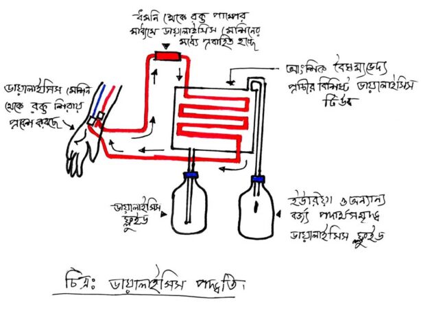 ডায়ালইসিস-পদ্ধতি